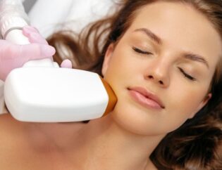 laser hair removal in Vienna, VA